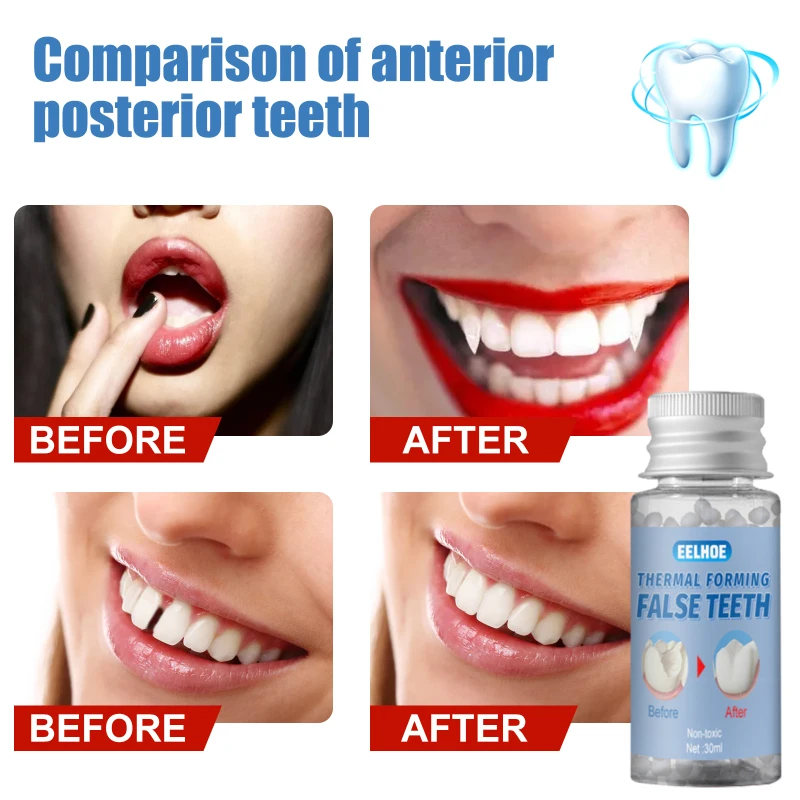 Pilt /386676/Ajutine-falseteeth-hammaste-tahke-liimi-kihvad-hamba-5_share/upload.jpeg