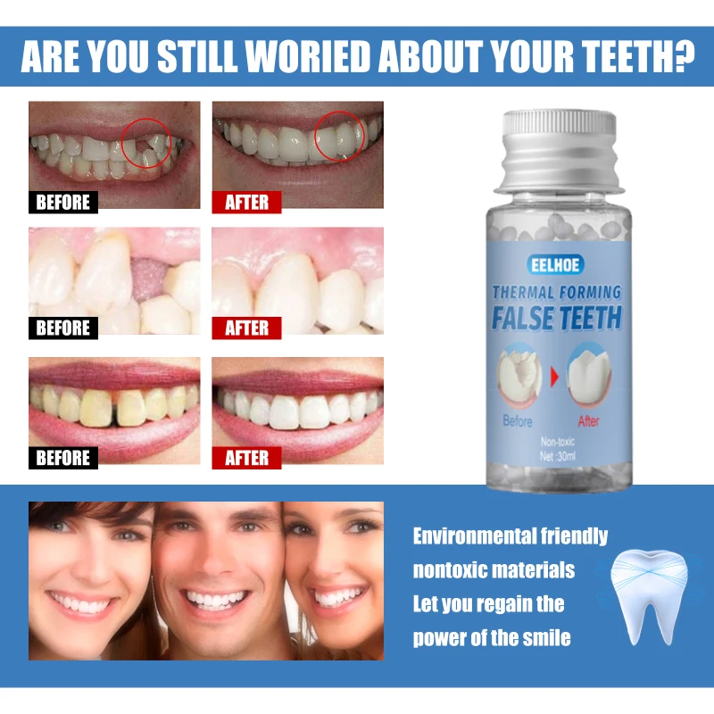Pilt /386676/Ajutine-falseteeth-hammaste-tahke-liimi-kihvad-hamba-6_share/upload.jpeg