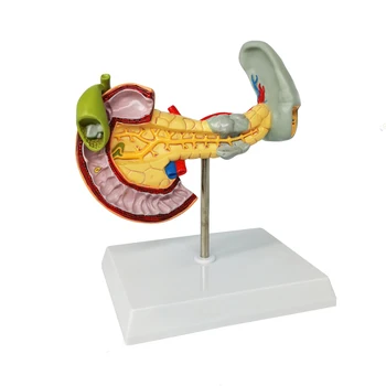 Anatoomilis-Patoloogilised Seedesüsteemi Mudel, Kõhunääre, Mille Põrna Ja Kaksteistsõrmiksoole Hariduse Tõendamine