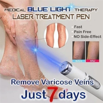 Sinine Valgus Ravi Laser Pen veenilaiendite Ravi Pehme Armi Remover Kirtsutama Eemaldamine Ravi Akne Pen Massaaž Lõõgastuda